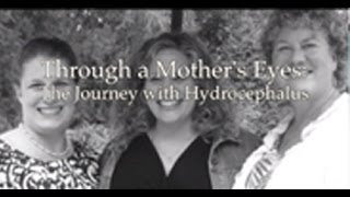 Through a Mother's Eyes: The Journey with Hydrocephalus
