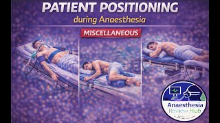 Patient Positioning During Anaesthesia | Miscellaneous | Anaesthesia Review Hub