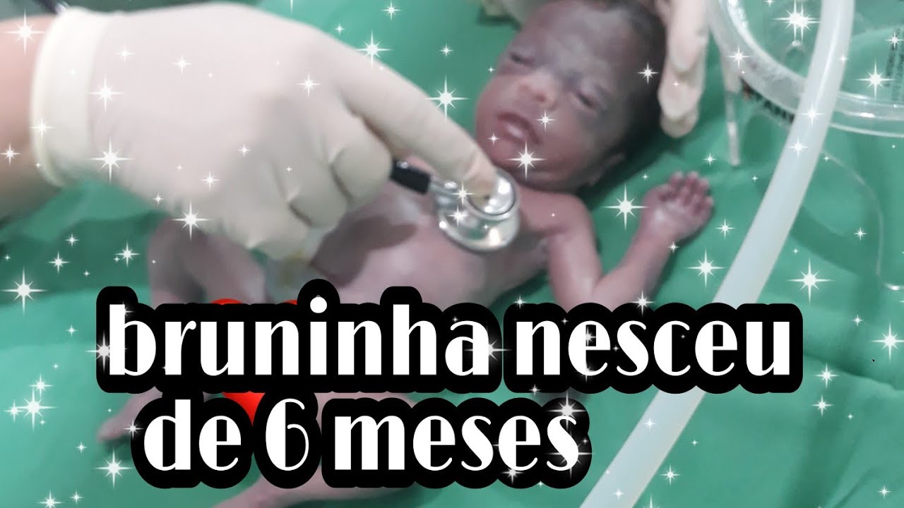 meu parto normal ganhei meu bebe com 6 meses de gestaçao#partoprematuro ...