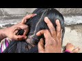 Routine Lightly Oiling for My Long Hair Care Nitpicking / LicePicking / Simple Hairstyle By Mother