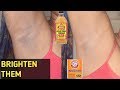 How To Brighten  Dark Underarms/Armpits (overnight) / Using Home Remedies &Stop Bad Odor in Armpits