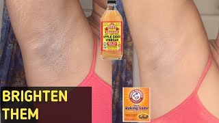 How To Brighten  Dark Underarms/Armpits (overnight) / Using Home Remedies &Stop Bad Odor in Armpits