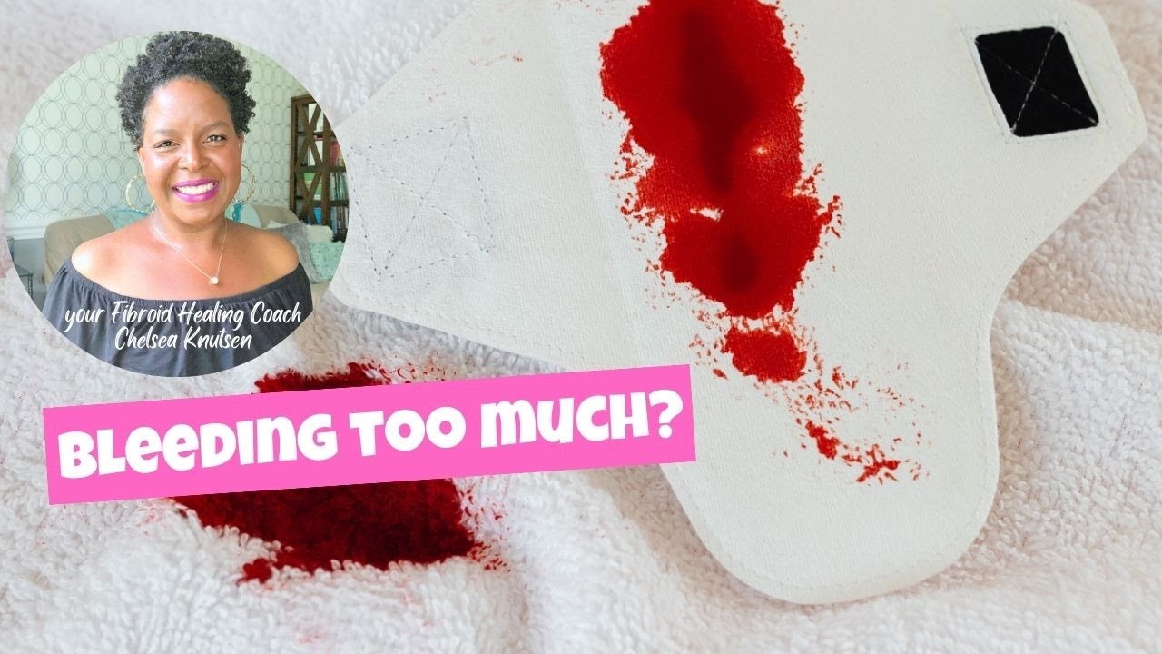 Dealing With Heavy Bleeding And Fibroids: What You Need To Know