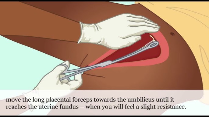 Ch p dale jinsiy aloqa 3fp transseksual videolar