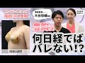 【医師が解説】豊胸後、何日経てば恋人にバレない!?