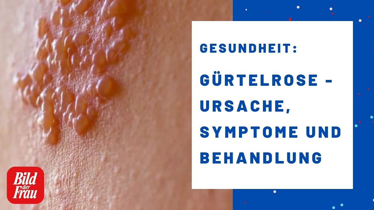 Was Hilft Bei Gürtelrose Schmerzen www.youtube.com