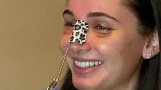 Emotional Rhinoplasty Reveal - Nose Job Reveal #rhinoplastyreveal