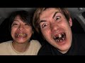 歯がヤバいことになった。だれか。。