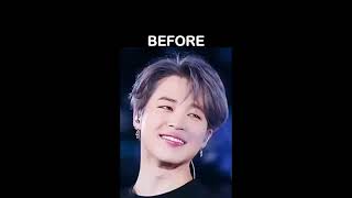 Before and after surgery of BTS #memes #funnyvideo #btsmems #bts
