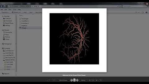 Retinal Blood Vessel Segmentation | +91-7973788405 for query