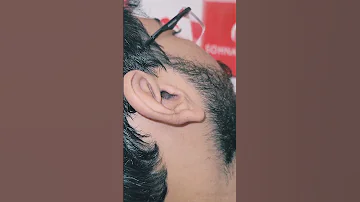 Earcleaningdrop Sohnasalon Karachi Mensgrooming Earwaxremoval Aesthetics Beauty Cosmetics 