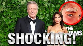 Alec Baldwin, Hilaria Baldwin Reveals SHOCKING Accident on Beach Getaway