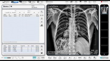 Taking X-Rays on ExamVue DR