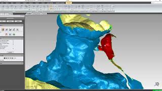 Finite element model of the talus joint: Isolating bones in Geomagic software #1 screenshot 1