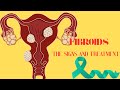 fibroids, the non cancerous benign growth in the uterus