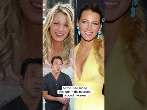 Blake Lively plastic