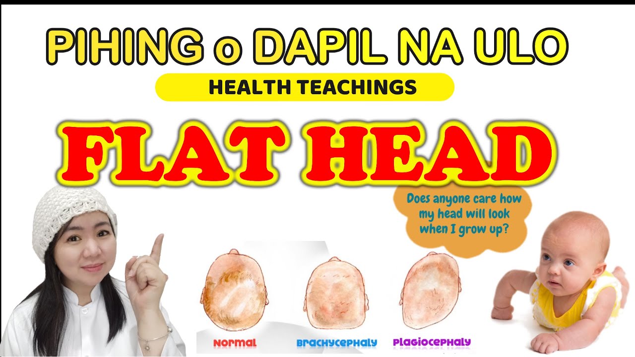 PIHING O DAPIL NA ULO I PATAG ANG ULO I FLAT NA ULO NG SANGGOL I FLAT HEAD SYNDROME I #SanggolTips