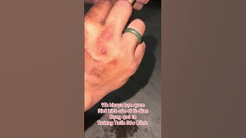 11h cứu bé Sóc - Trương Tuấn Sóc Cảnh