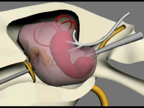 Video: 3 formas de diagnosticar un desgarro en el músculo de la pantorrilla