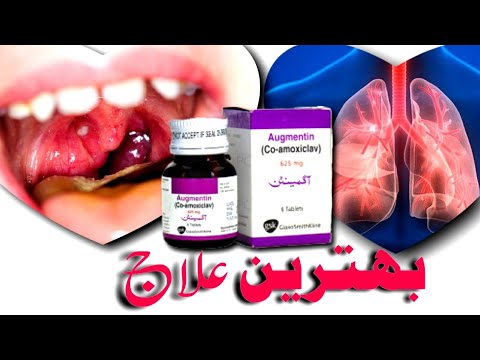 Video Augmentin 625 uses Side Effects Best Treatment |Salam... - youtube
