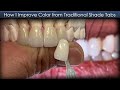 How I Improve Tooth Color from Traditional Shade Tabs | Dental Lab Education