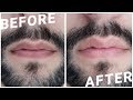 Lighter, Pinker, Plumper Lips -  Dry Lips / Lighten Dark Lips  ✖ James Welsh