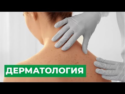 Видео: Принимает ли дерматолог медицинскую помощь?