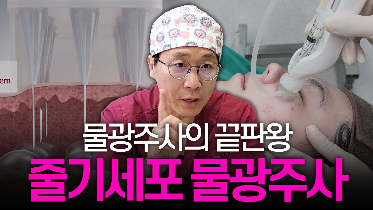 리X란 vs 줄기세포 주사, 뭐가 다를까? 물광주사 계급도 완벽 정리 | 스킨부스터 | 배양액 | SVF