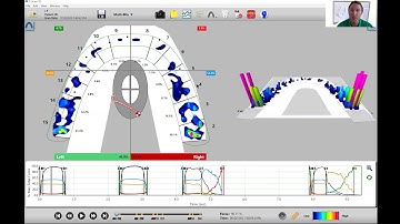 Setting up Arch & Quadrants in T-Scan Software