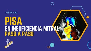 Te Lo Explico Pisa En Insuficiencia Mitral Paso A Paso
