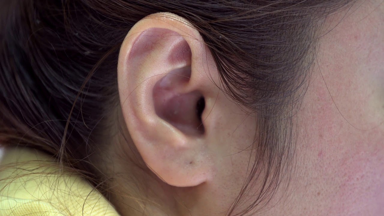 Earlobe Repair Manchester | Cheshire