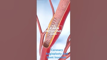 CORONARY ANGIOPLASTY AND STENT INSERTION