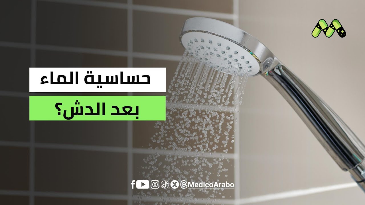 حساسية الماء بعد الاستحمام: التشخيص والعلاج