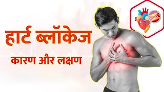 Heart Blockage I blocked artery I हार्ट ब्लॉकेज के कारण और लक्षण