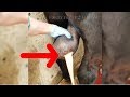 Abscess Drain Compilation (New)