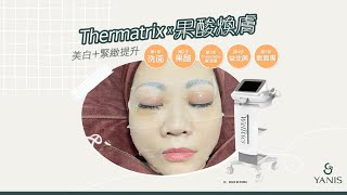 Yanis Beauty - 美白 緊緻一次過