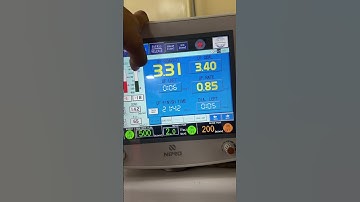 Dialysate sodium & Time  adjustment in nipro machine/ Dialysis machine function  #dialysistechnician