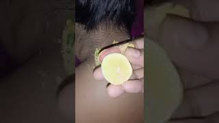 Home remedies | for dark neck | underarms | Diya beauty parlour