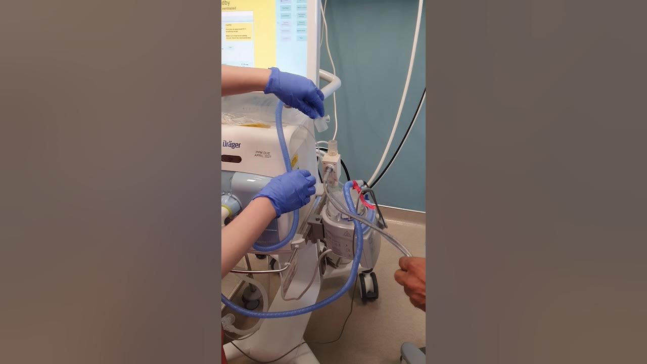 Setting up the inhaled nitric oxide in NICU YouTube