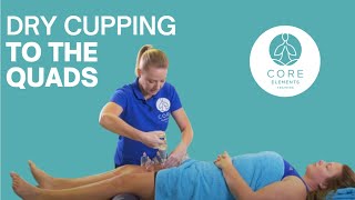 Dry Cupping to the Quadriceps using soft tissue release and active movement technique