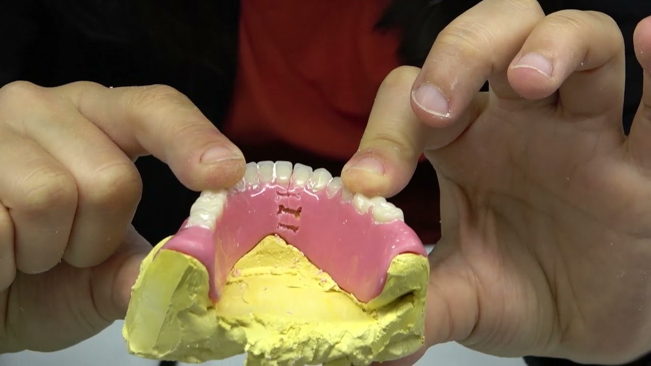 Totel Protezde Tamir (Part 2)