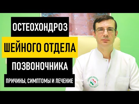 Остеохондроз Шейного Отдела Позвоночника. Симптомы и лечение шейного остеохондроза