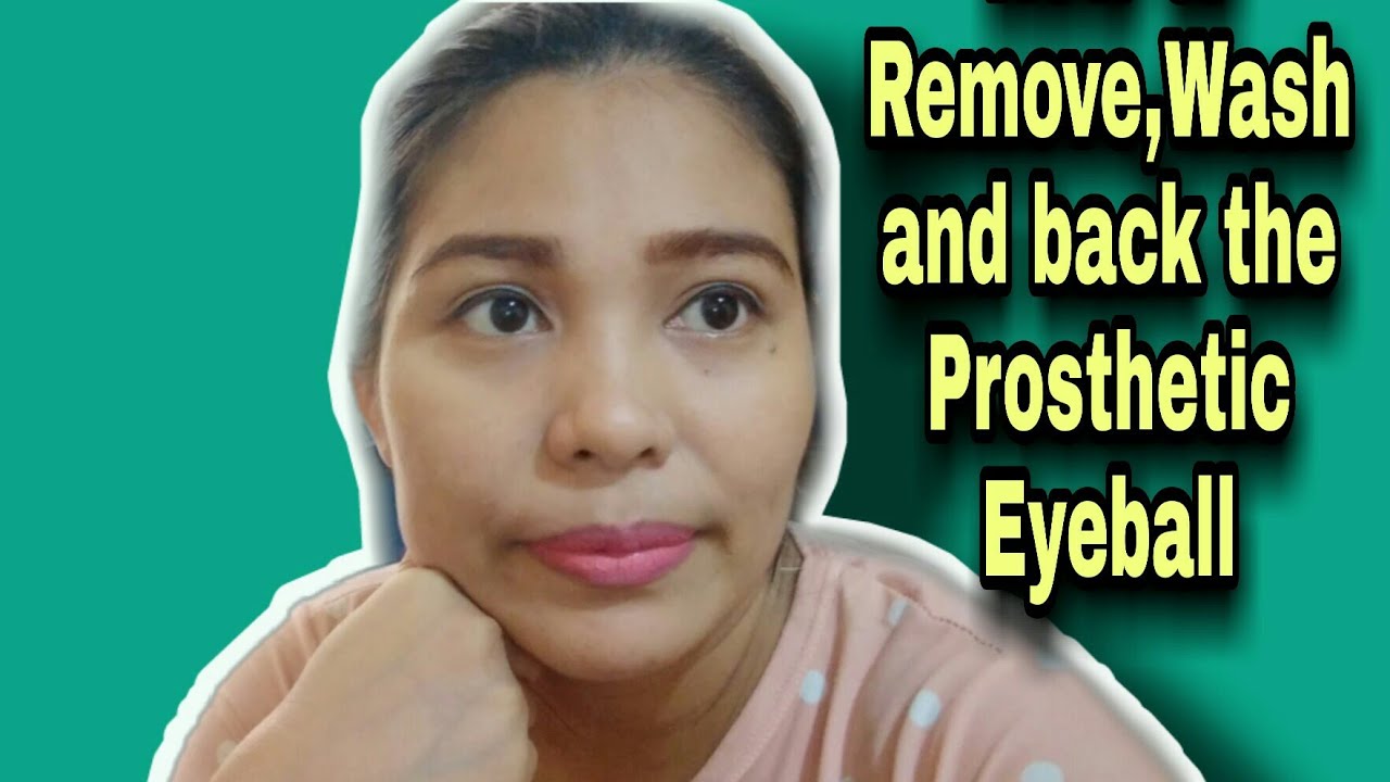 How To Remove, Wash, Back The Prosthetic Eyeball YouTube