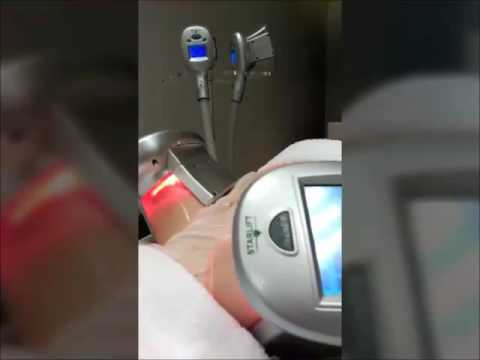 Que es la crioterapia para bajar de peso