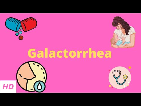Galactorrhea, Causes, Signs and Symptoms, Diagnosis and Treatment.