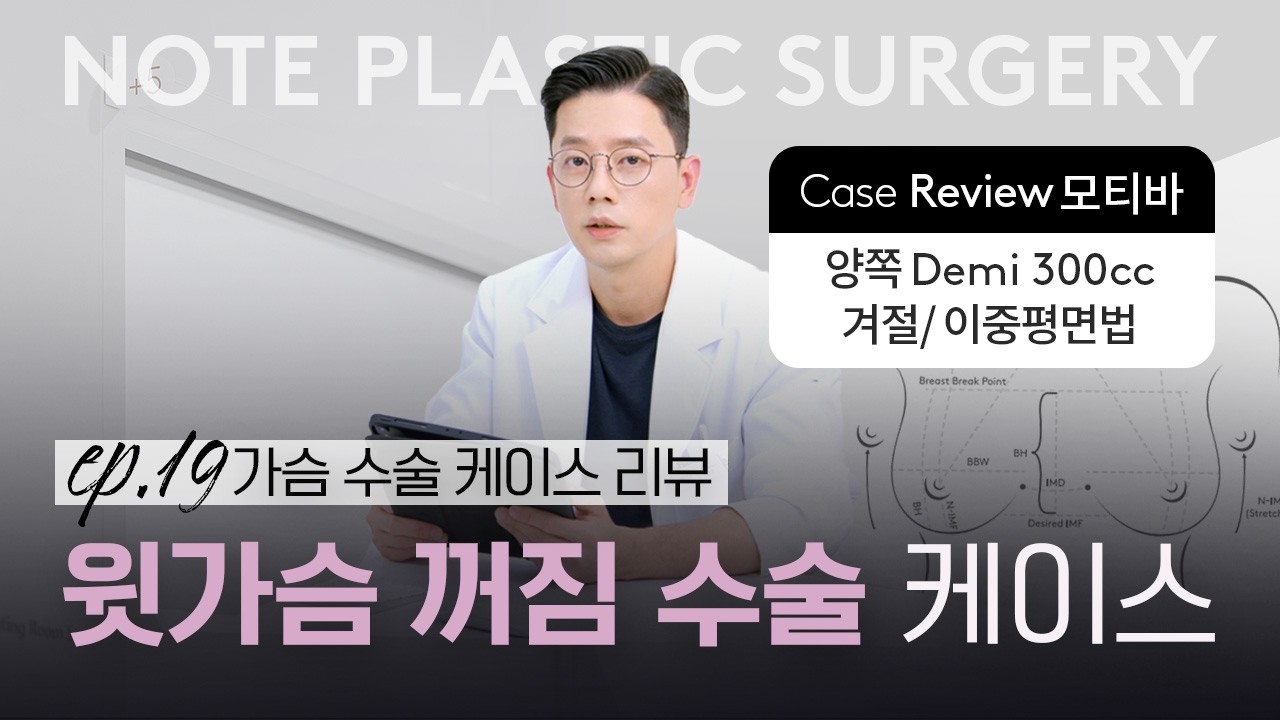 [가슴수술 리뷰] 가슴수술후기 l 윗가슴꺼짐 l 윗볼륨 l 모티바 가슴성형 l 노트성형외과