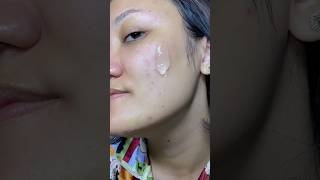 Review Face Wash untuk Kulit Sensitif dan Berjerawat