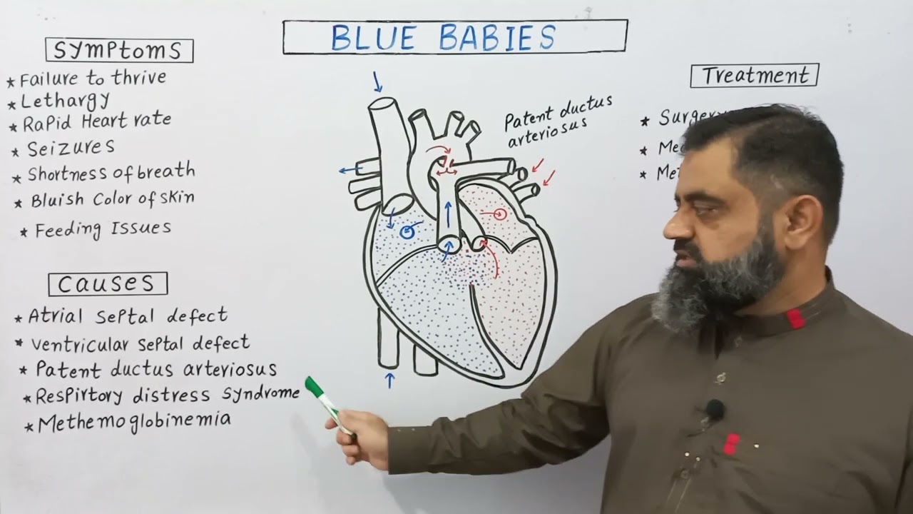 Blue Babies Urdu/Hindi medium 