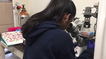Project 3 | Viewing Fibroblasts Under The Microscope