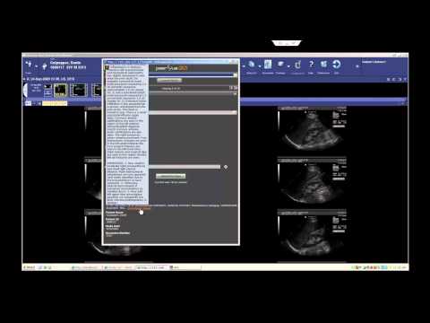 peerVue QICS Peer Review Demo (McKesson)